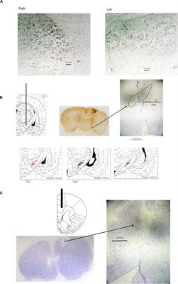 Subthalamic Stimulation Inhibits Bladder Contraction by Modulating the Local Field Potential and Catecholamine Level of the Medial Prefrontal Cortex